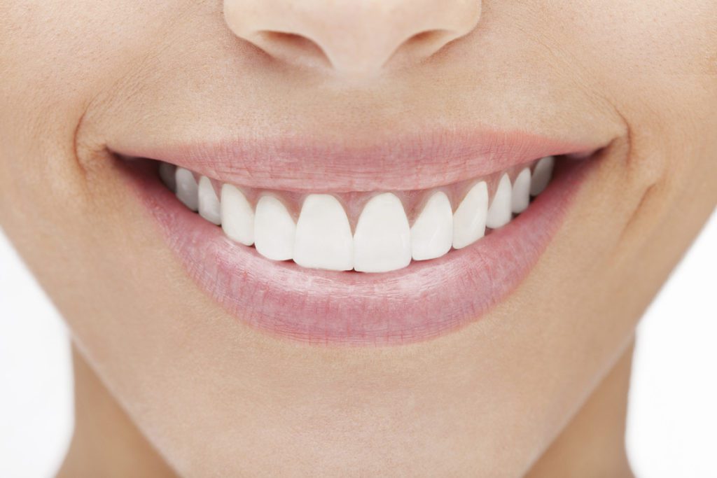 Sbiancamento denti, dal dentista dura di più - e fa meno danni!