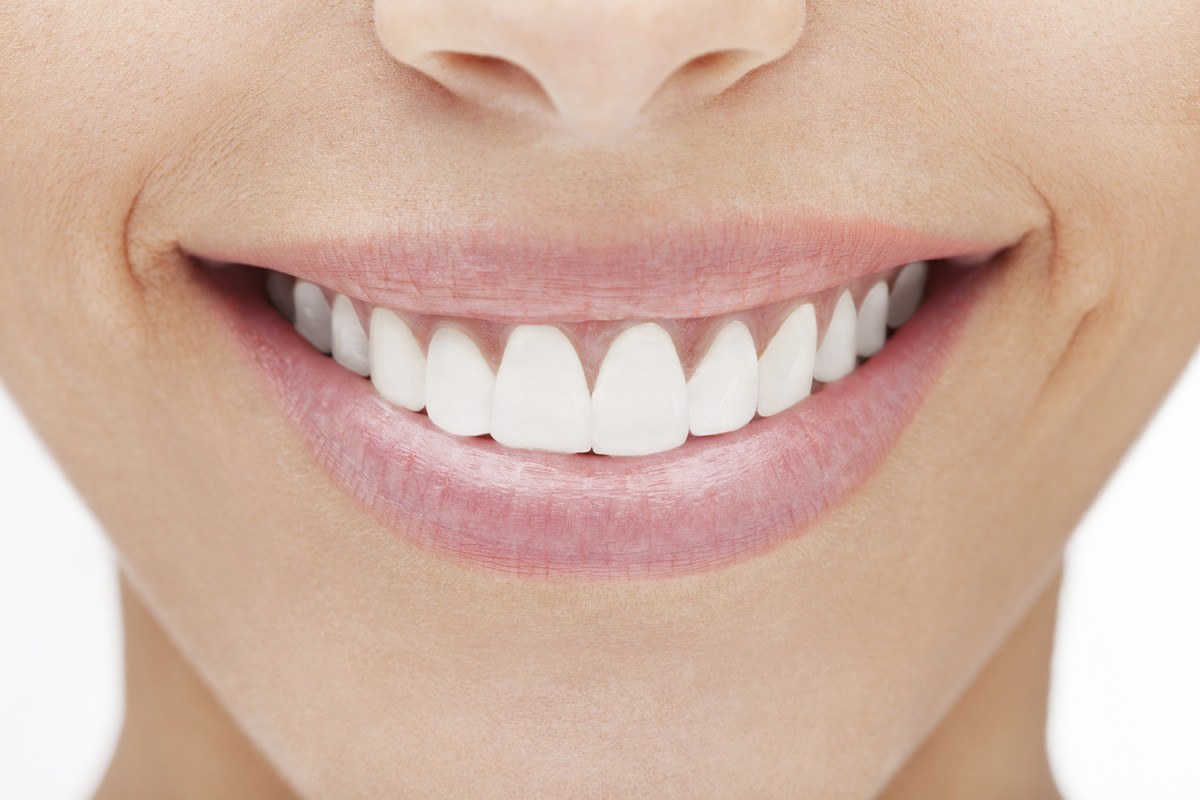 Sbiancamento denti, dal dentista dura di più – e fa meno danni!