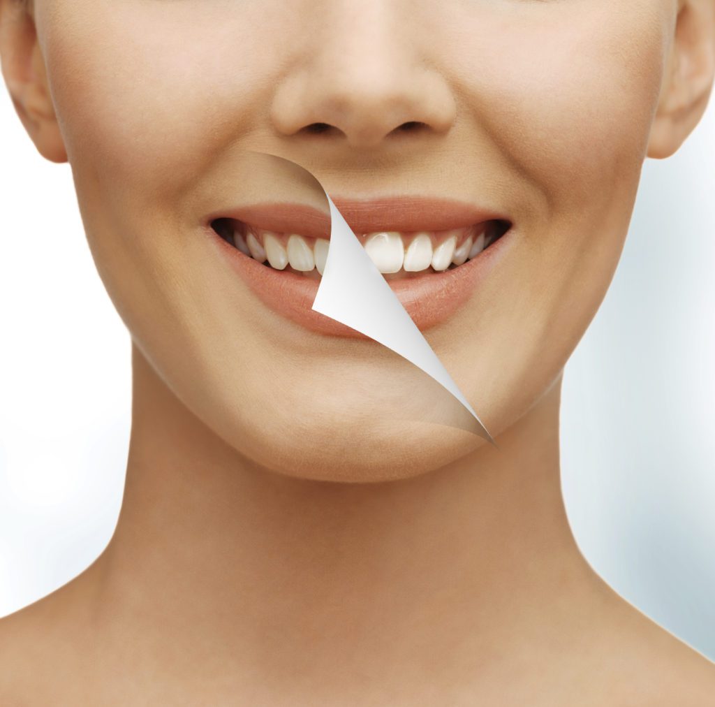 Ecco qualche consiglio su come avere denti bianchi!